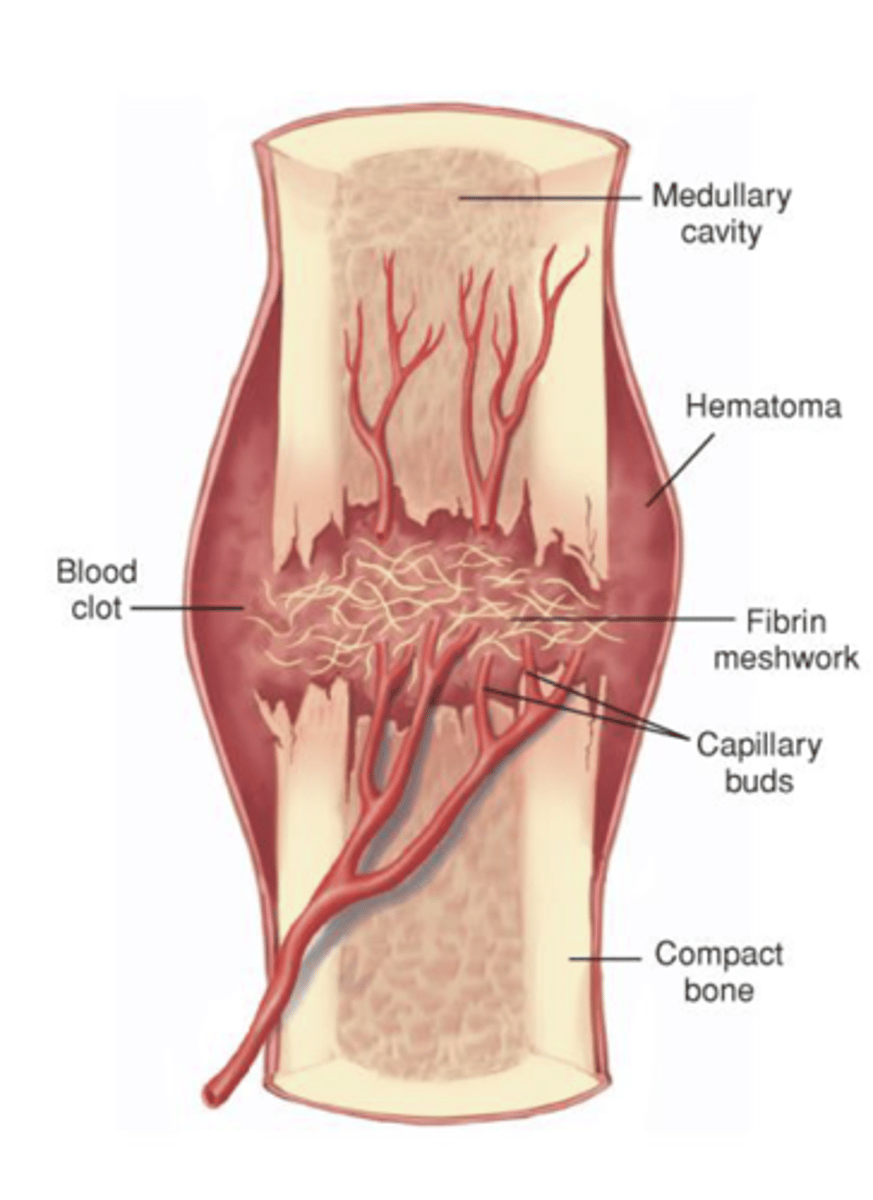 <p>Blood vessels in the bone and surrounding tissues bleed into and around the fragments forming a hematoma</p><p>Fibrin meshwork forms and seals the fracture site</p><p>-- Initiates healing process</p>