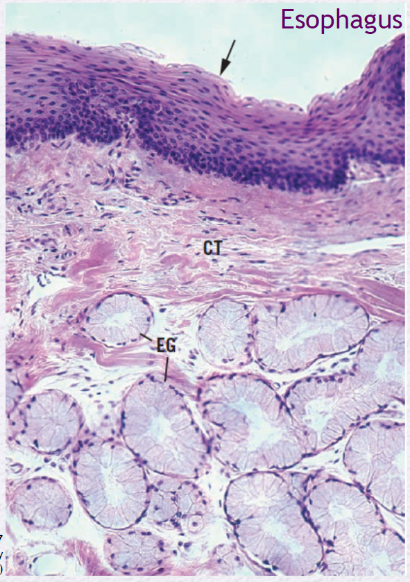 <p>Identify the Epithelium (arrow)</p>