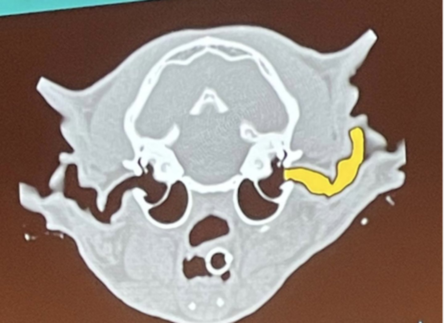 <p>What is being highlighted in yellow?</p>