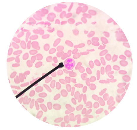 <p>what kind of white blood cells is this?</p>