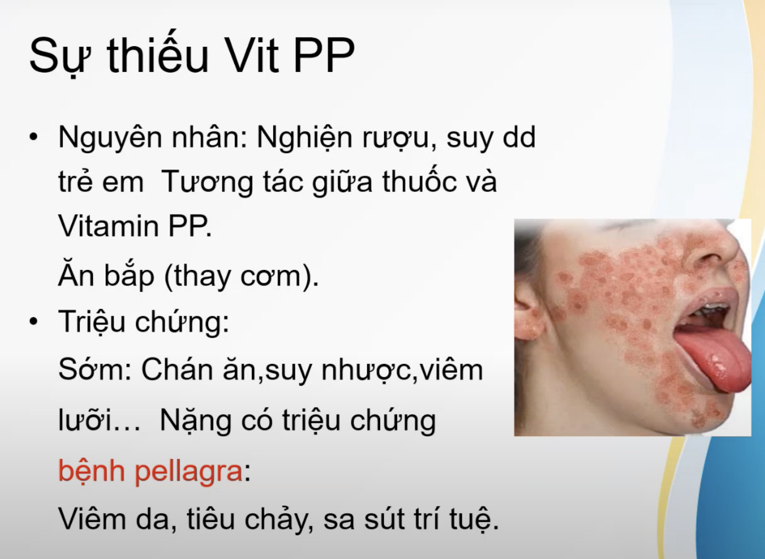 <p><strong>Vitamin PP là tên gọi khác của:</strong></p><p>A. Vitamin B6</p><p>B. Vitamin B2</p><p>C. Vitamin B3</p><p>D. Vitamin B9</p>
