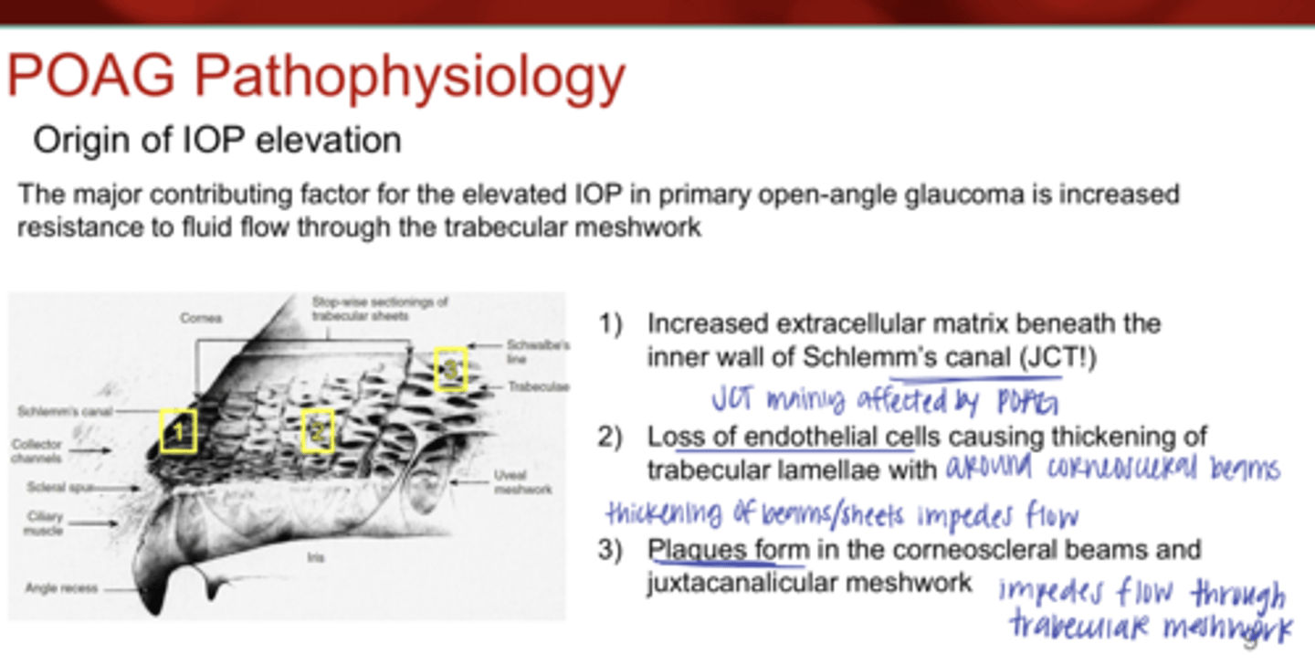 <p>What is the major contributing factor for the elevated IOP in primary open-angle glaucoma?</p>