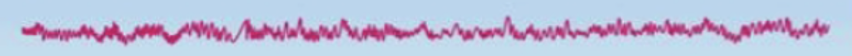 <p>what state of wakefullness/ sleep does this EEG depict?</p>