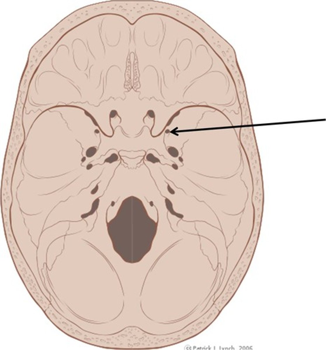 <p>(Sphenoid)</p><p>Openings located in the medial part of the greater wing; a branch of cranial nerve V passes through</p>