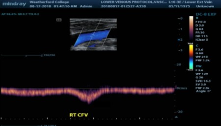 <p>What has been done for the waveform to appear this way?</p>