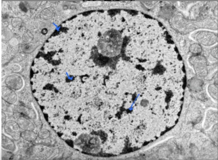 <p>Identify the following structures in electron micrograph</p>