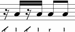 <p>What Variation is This? </p>