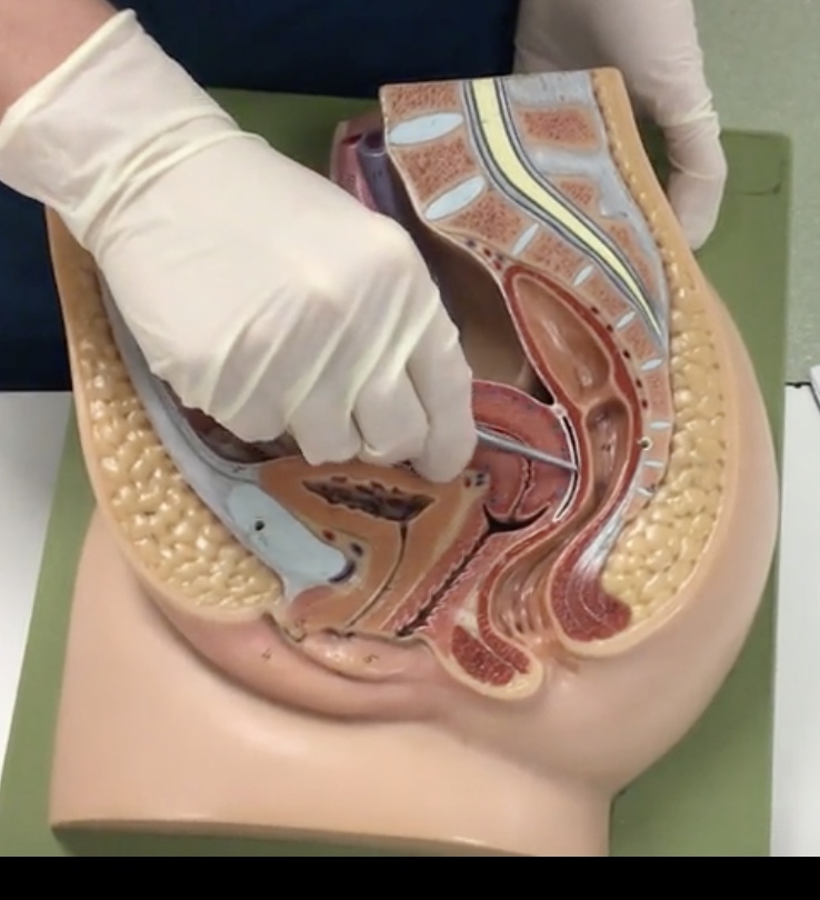 <p>Description: Recess between the rectum and uterus</p><p>Relationship: Most inferior part of the abdominopelvic cavity in females</p>