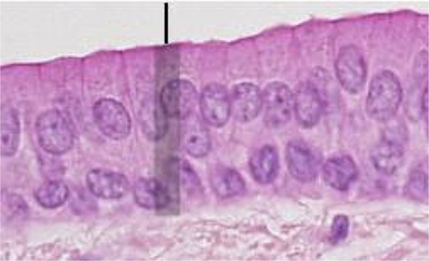 <p>Stratified columnar epithelium</p>