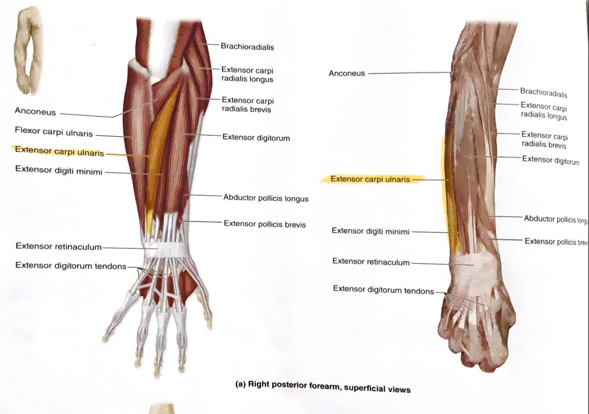 <p>Action: Extend, adduct wrist ( towards body midline, ulnaris= pinky side)</p>