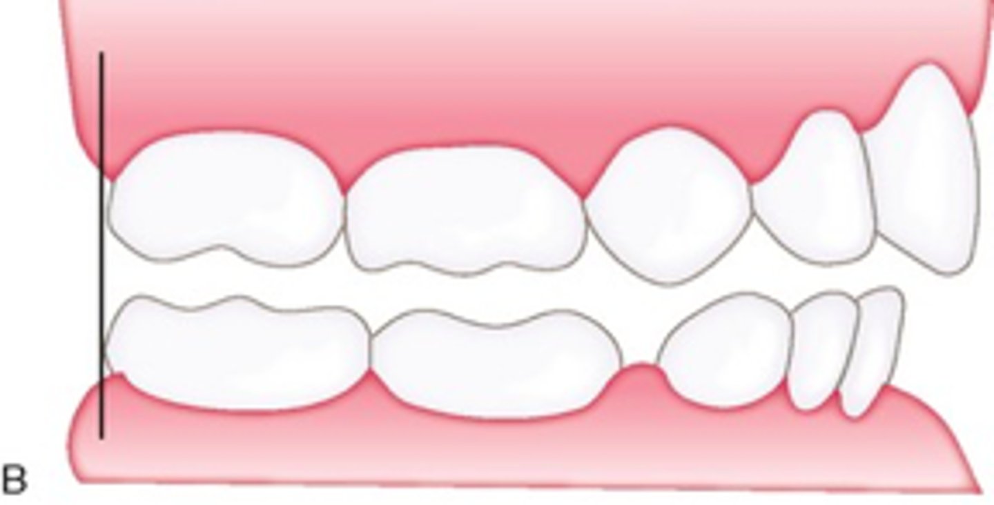 <p>ID the terminal plane:</p>