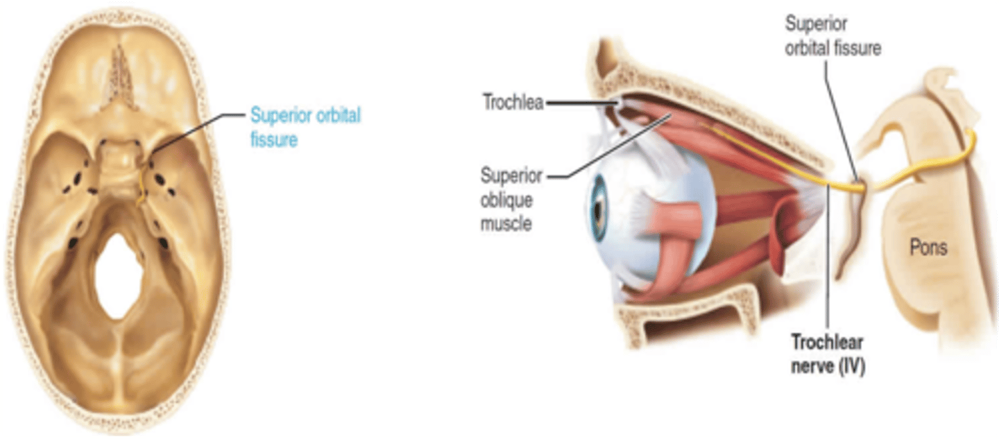 <p>Superior Orbital Fissure</p>