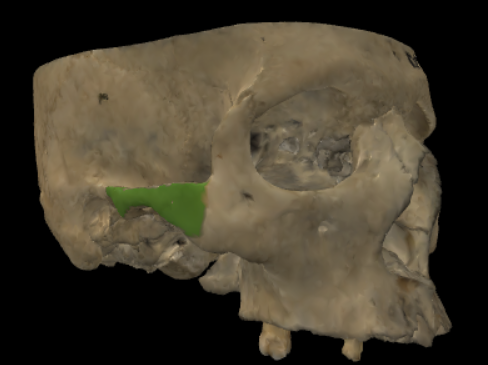 term image