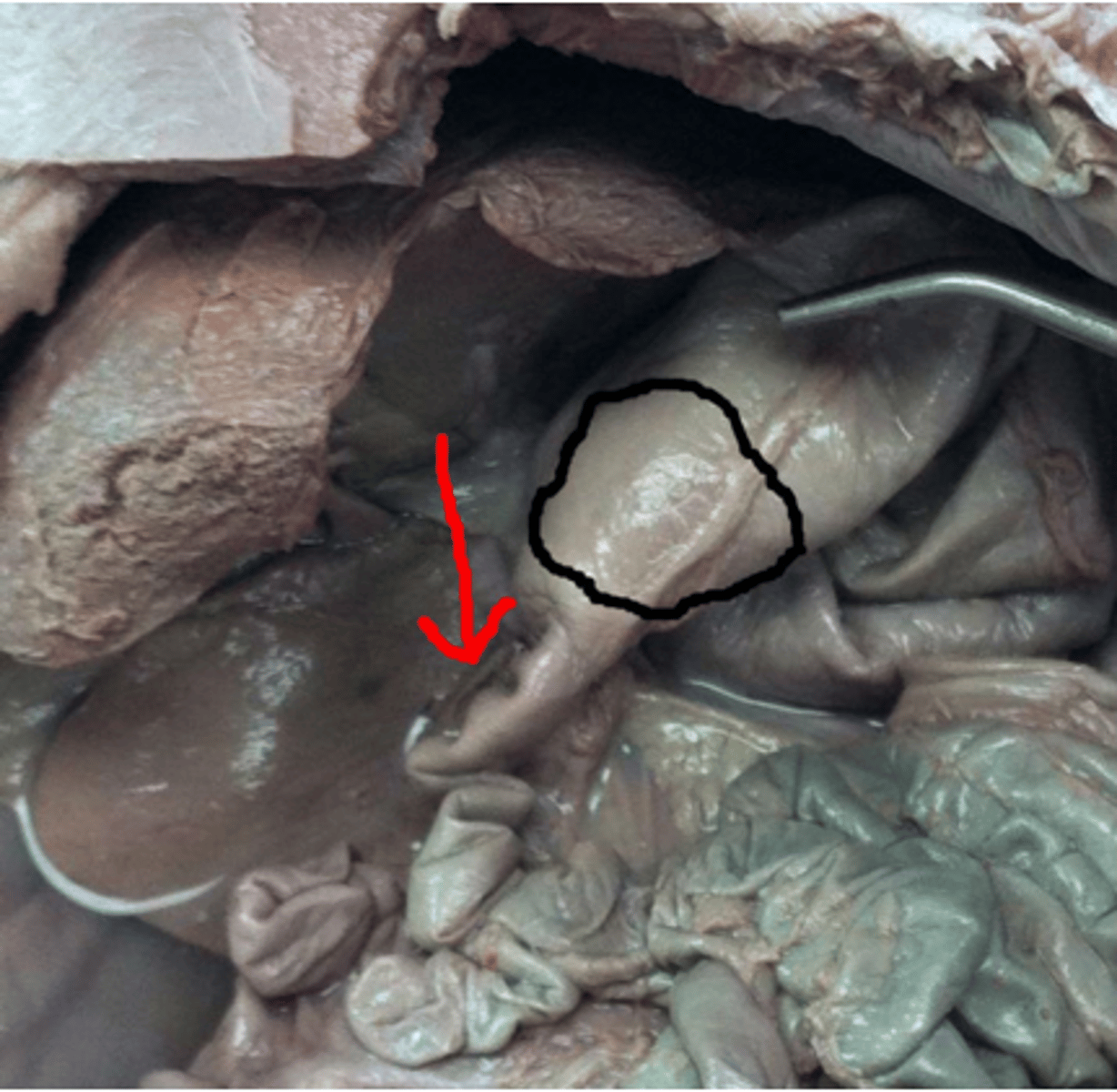 <p>Black circle is the pyloric section, the red arrow is ____</p><p>It connects the stomach and small intestine, prevents flowback of food from stomach.</p>