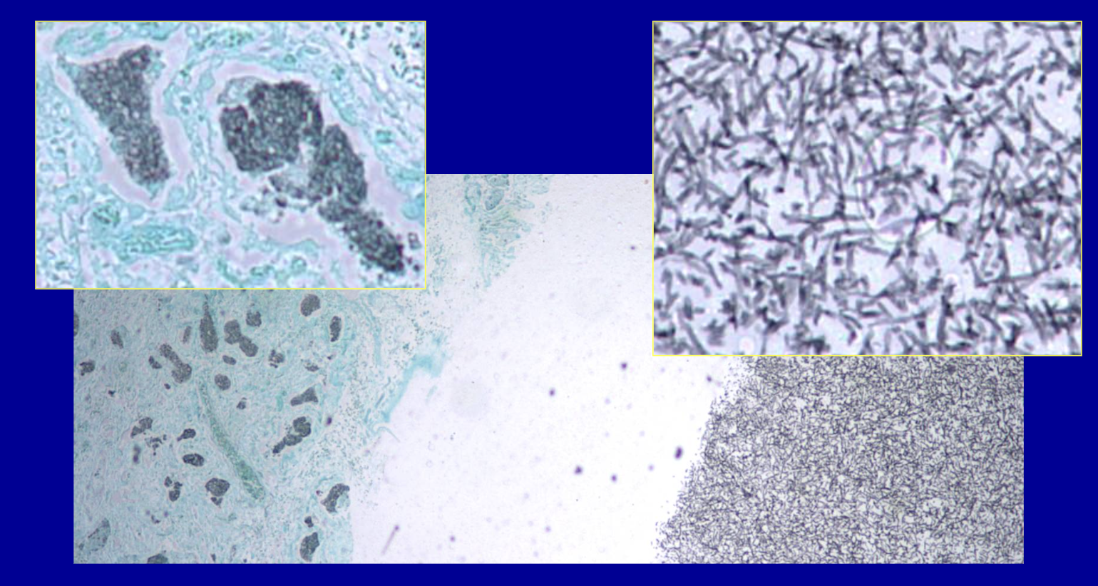 <p>ID the stain type </p>