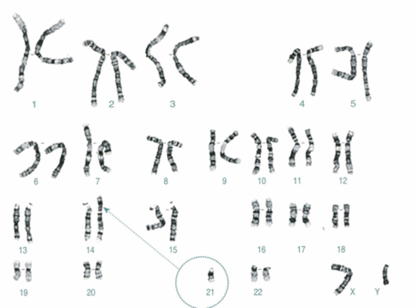 <p>Name:</p><p>- Correctly written karyotype</p><p>- Common name</p><p>- Scientific name</p><p>- One distinguishing clinical feature</p><p>- Definition of this feature if not obvious</p>