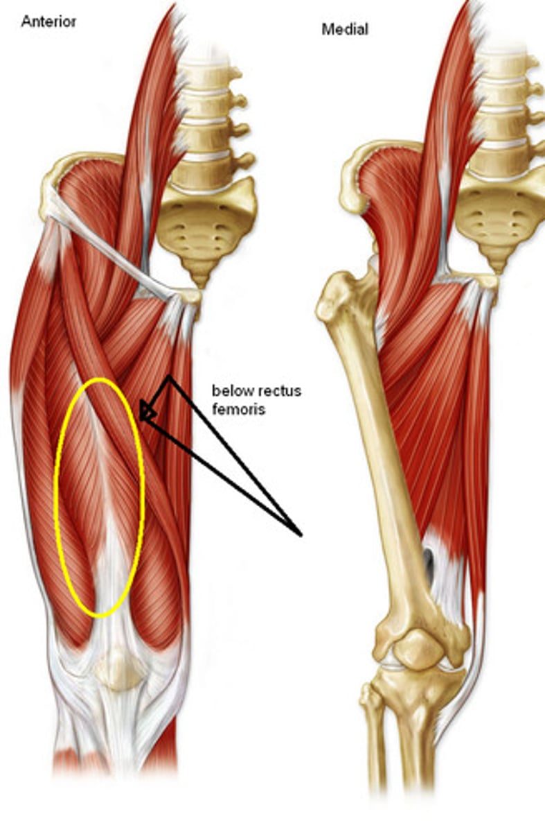 <p>Origin: anterior and lateral surfaces of shaft of femur</p><p>Insertion: via common tendinous (quadriceps tendon) and independent attachments to base of patella; indirectly via patellar ligament to tibial tuberosity</p><p>Innervation: femoral nerve (L2, <strong>L3, L4)</strong></p><p>Action: extends knee joint</p>