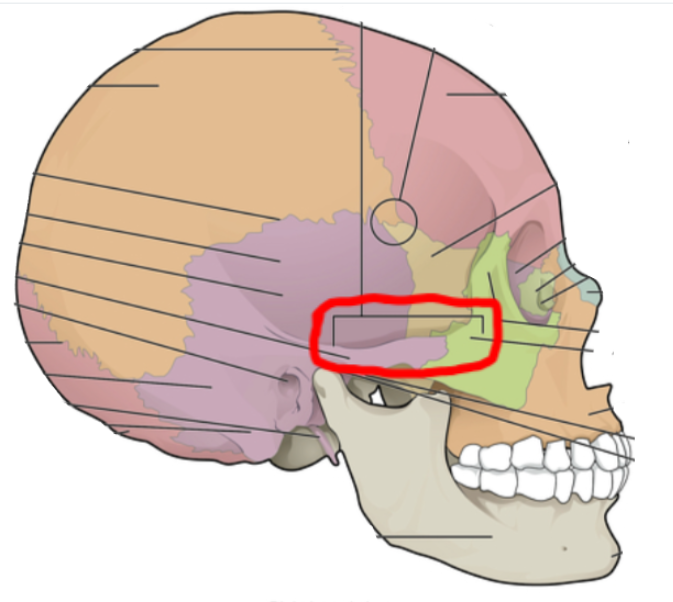 term image