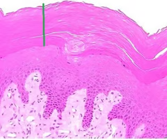 term image