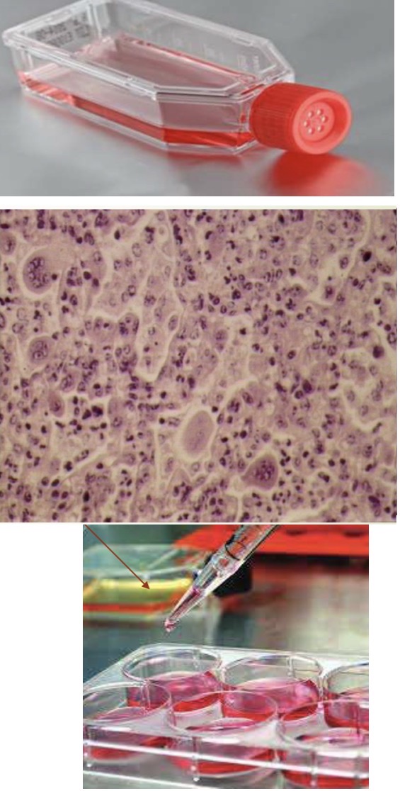 <p>A- identify</p><p>B-Used for</p><p>C- How to prepare it</p><p>D- The morphology</p><p>E- Example</p><p>F- List other cytopathic effect</p><p>Types of tissue culture</p>