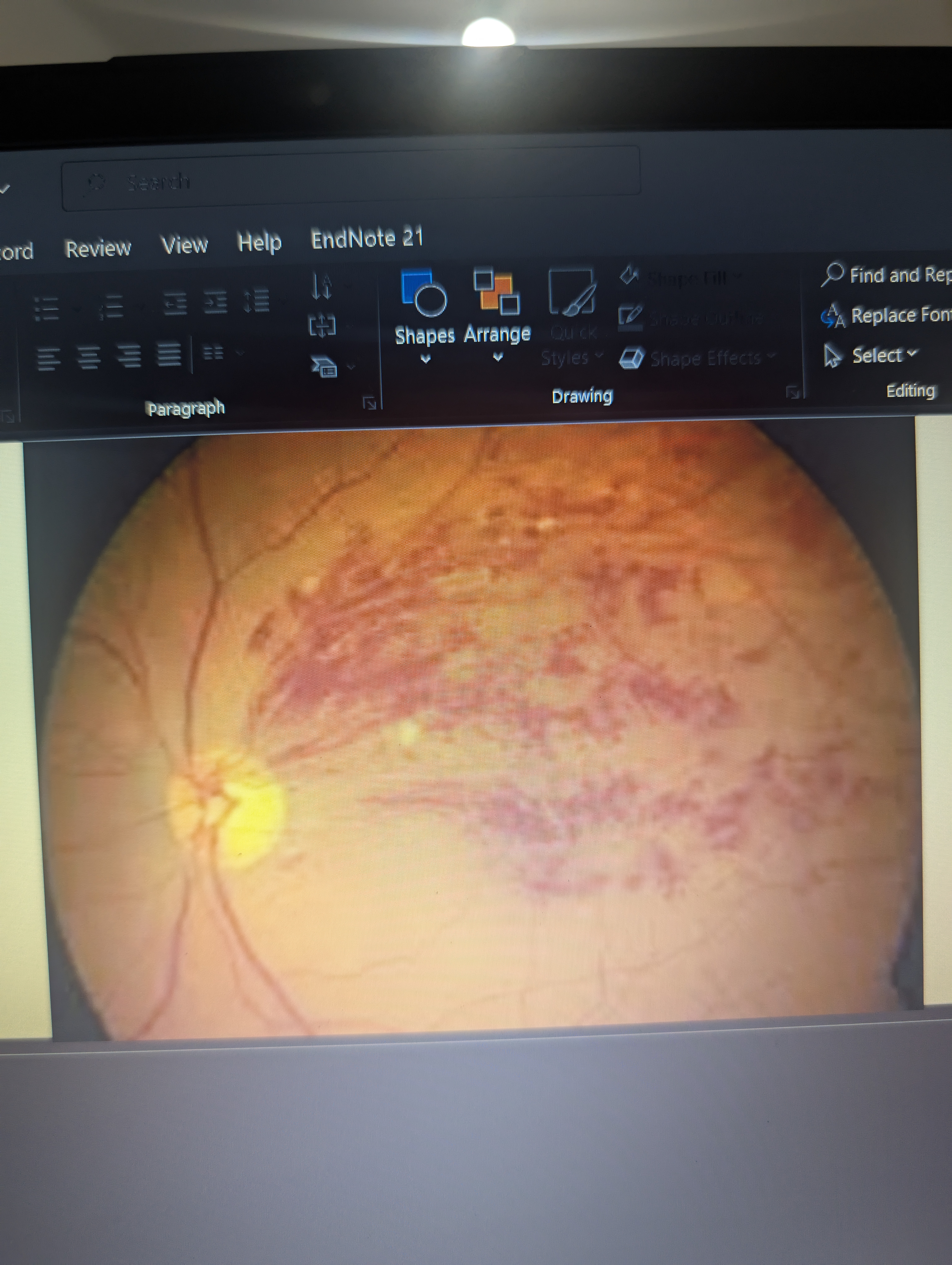 <p>What is this pathology?</p>