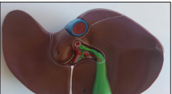 <p>identify the organ </p><p>what is the function of the organ and where does its duct open </p><p>identify the green part </p><p>what is its function </p><p>where does its duct open </p>