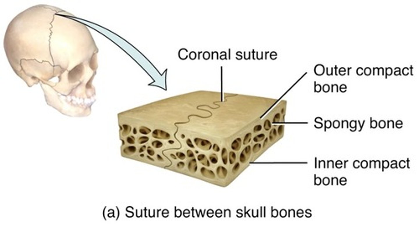 <p>interlocking line of union between bones made with dense fibrous connective tissue; skull</p>