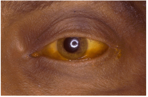 term image