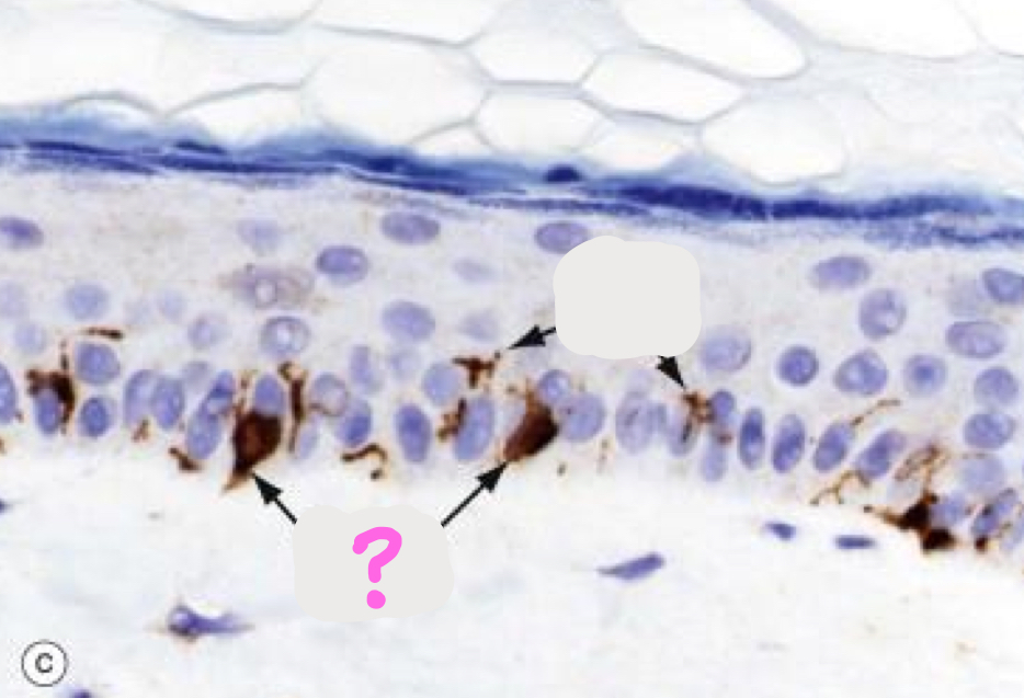 <p>What type of cells are depicted on this histology slide?</p>