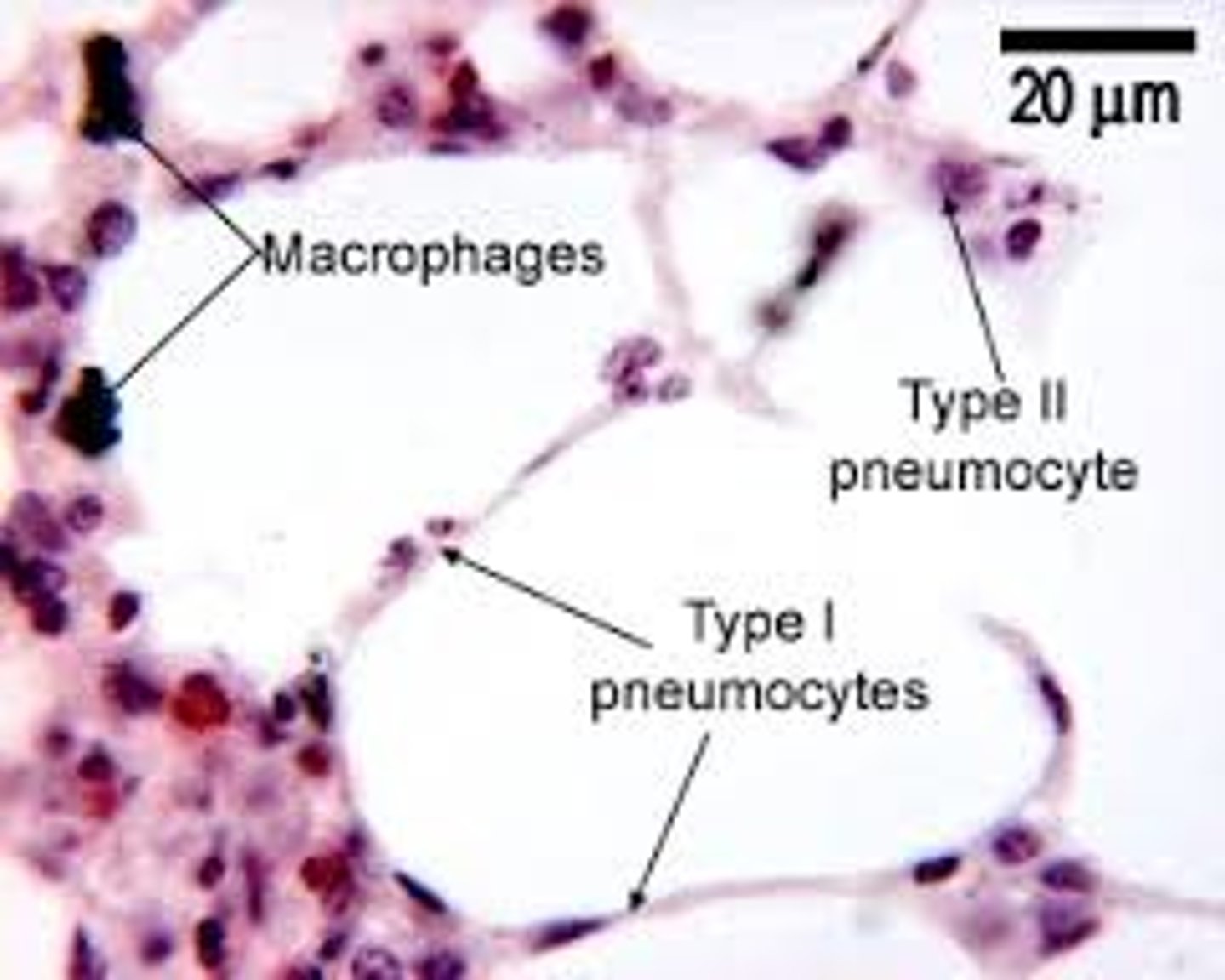 <p>a) Extremely thin alveolar cells that are adapted to carry out gas exchange</p><p>b) Simple squamous epithelial cells</p>