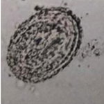 <p><strong>Metastrongylus spp</strong>. - nematodes, infecting lungs of pigs (Lung worm)</p><ul><li><p>S, spherical, symmetrical, 2 thick shells, embryonated (L1), transparent</p></li></ul><p></p>