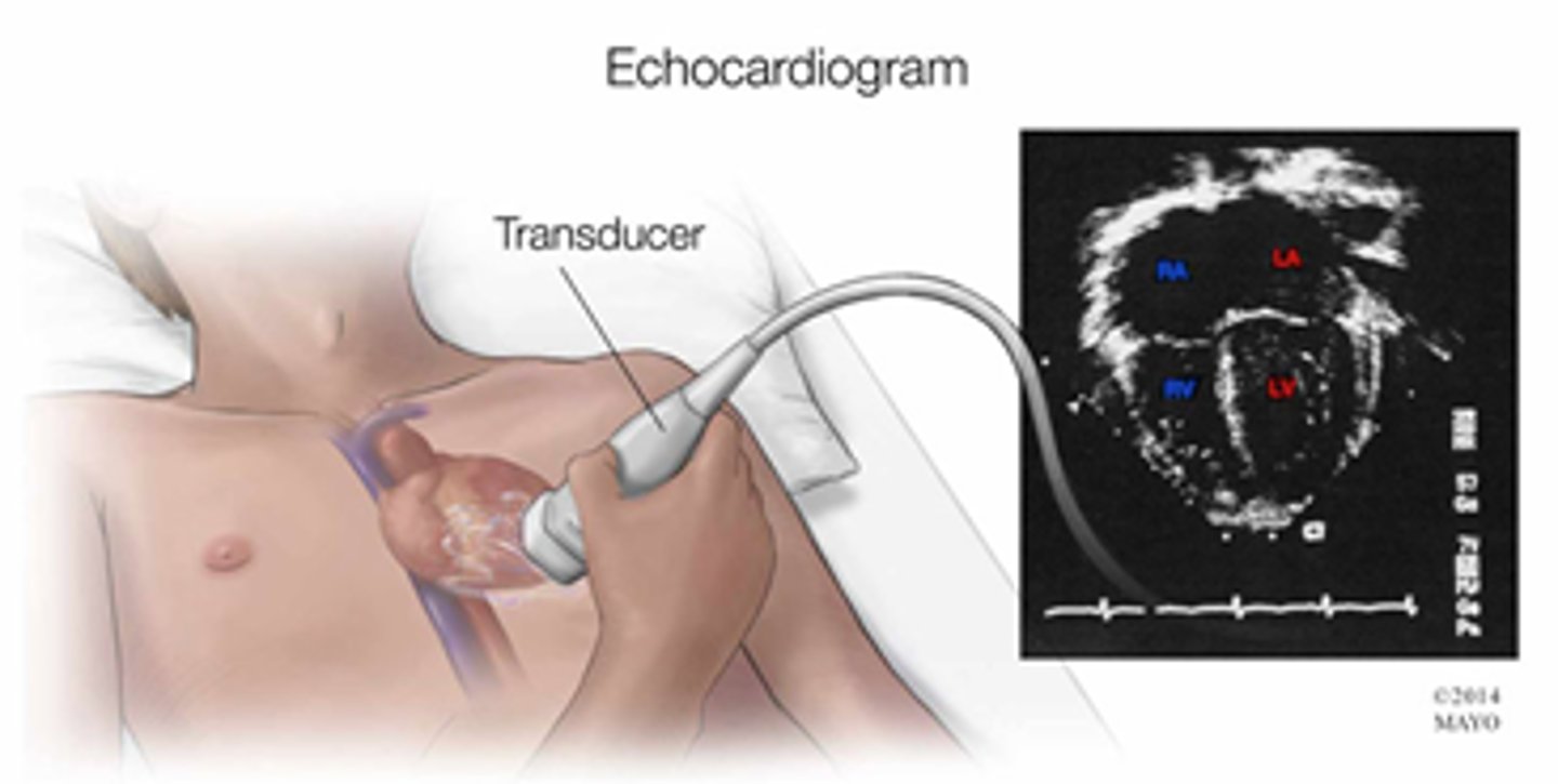 <p>ultrasound recording of heart function</p>