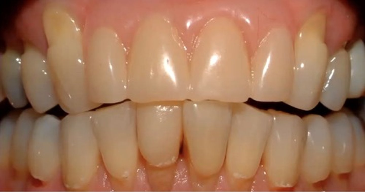 <p>identify the type of differential diagnosis</p>