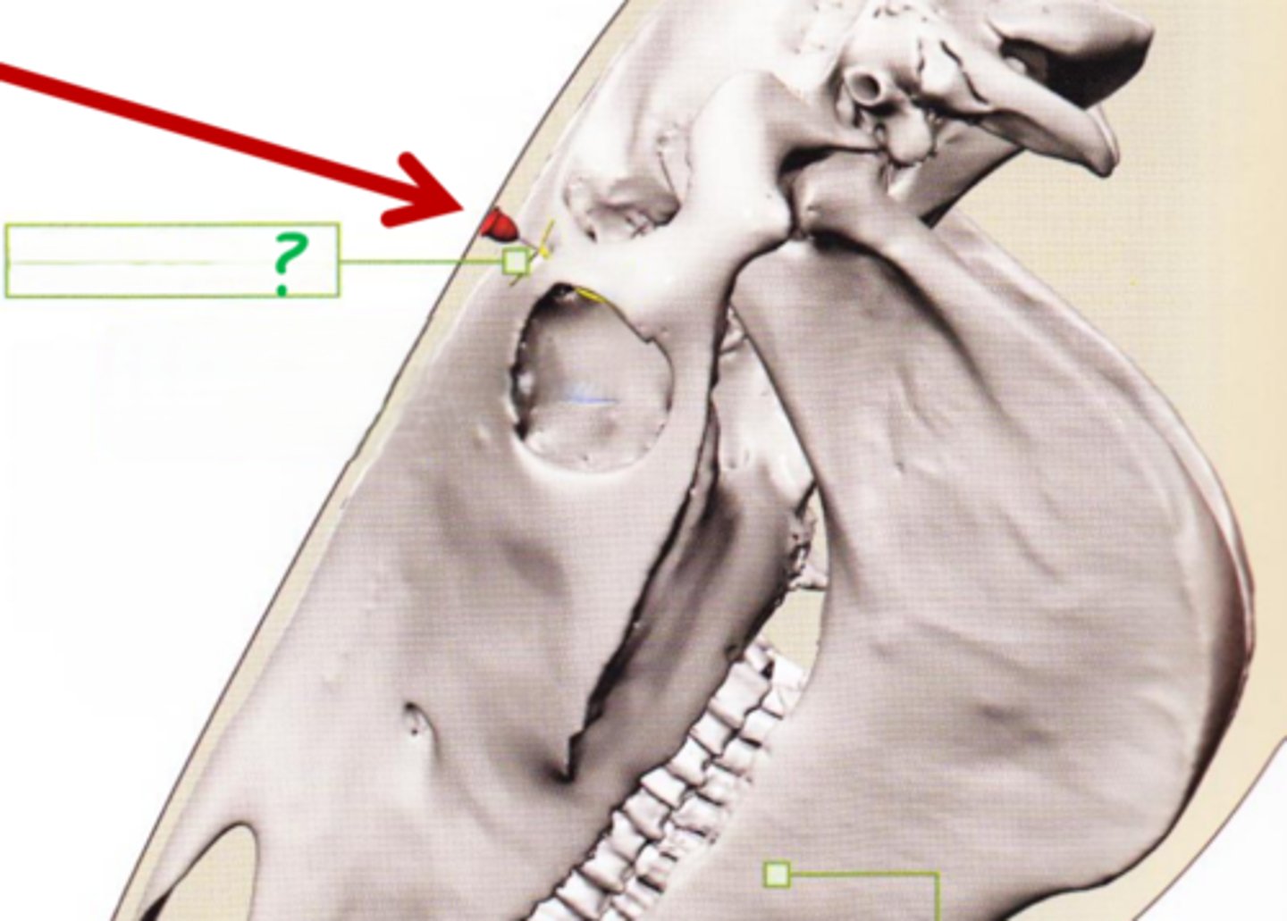 <p>What is the opening the needle is in?</p>
