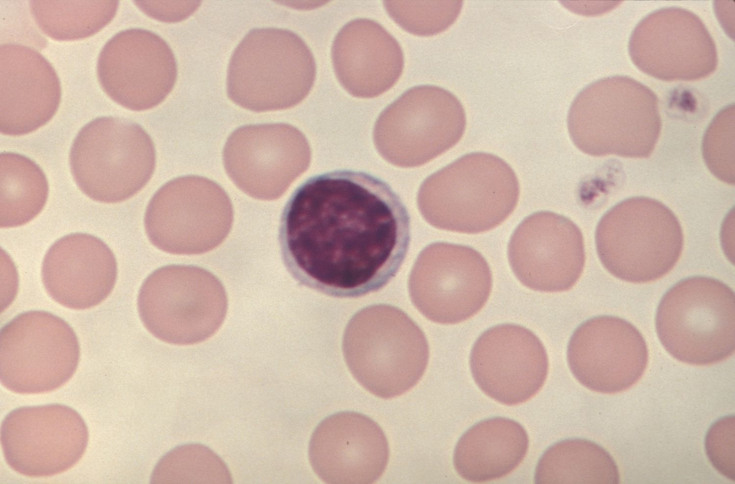 <p>What type of WBC is this?</p>
