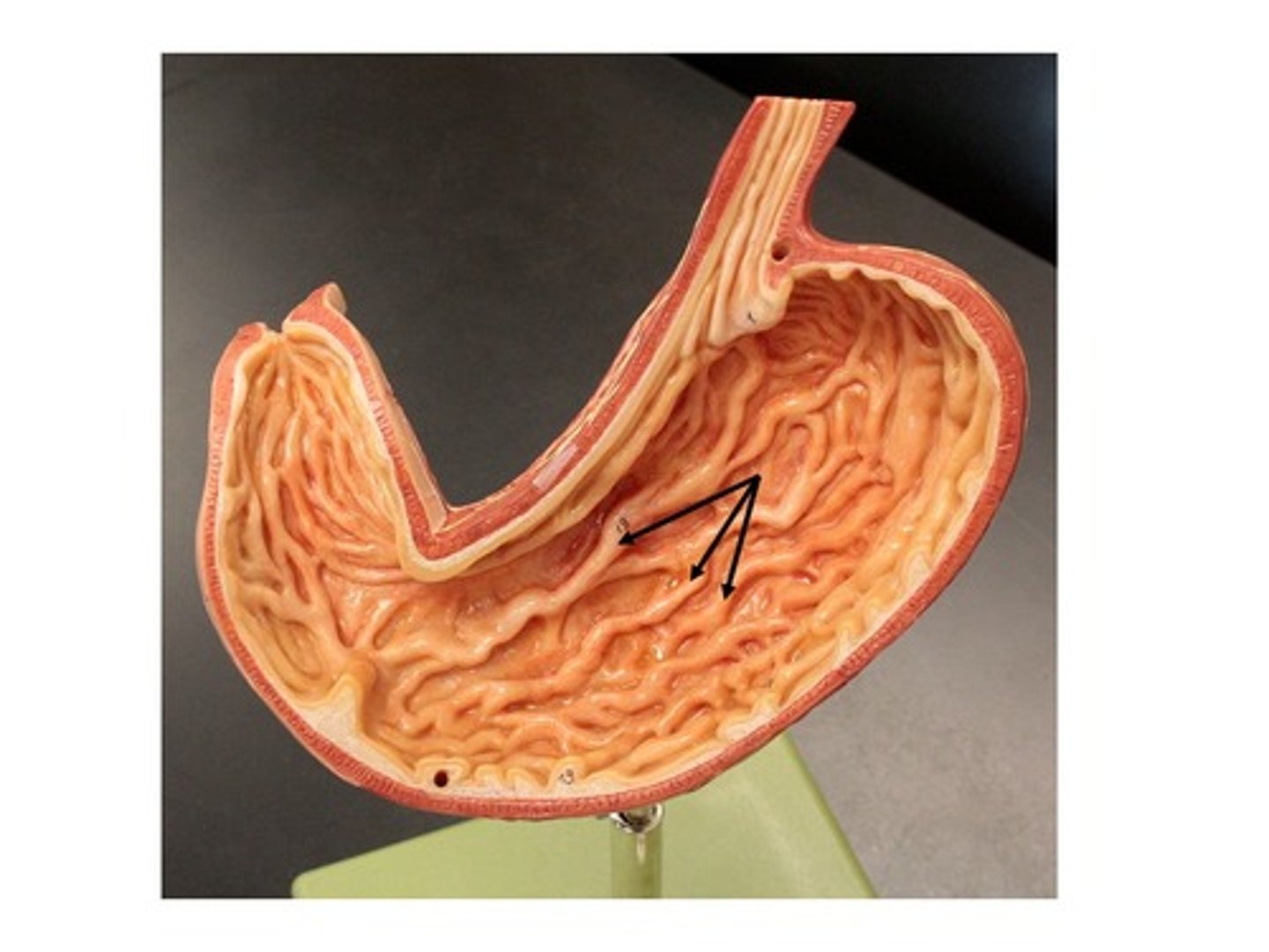 knowt flashcard image