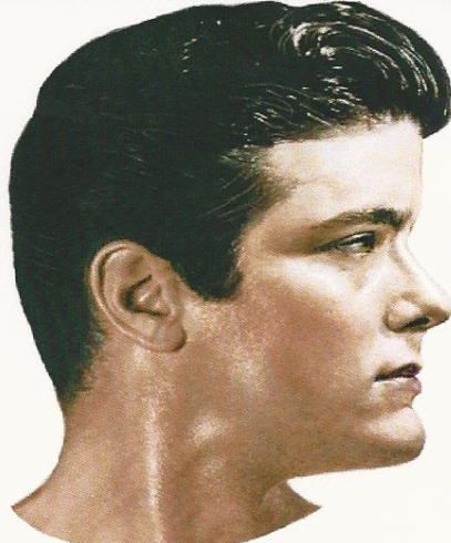 <p>P<span>rotruding forehead; Straight Chin</span></p>