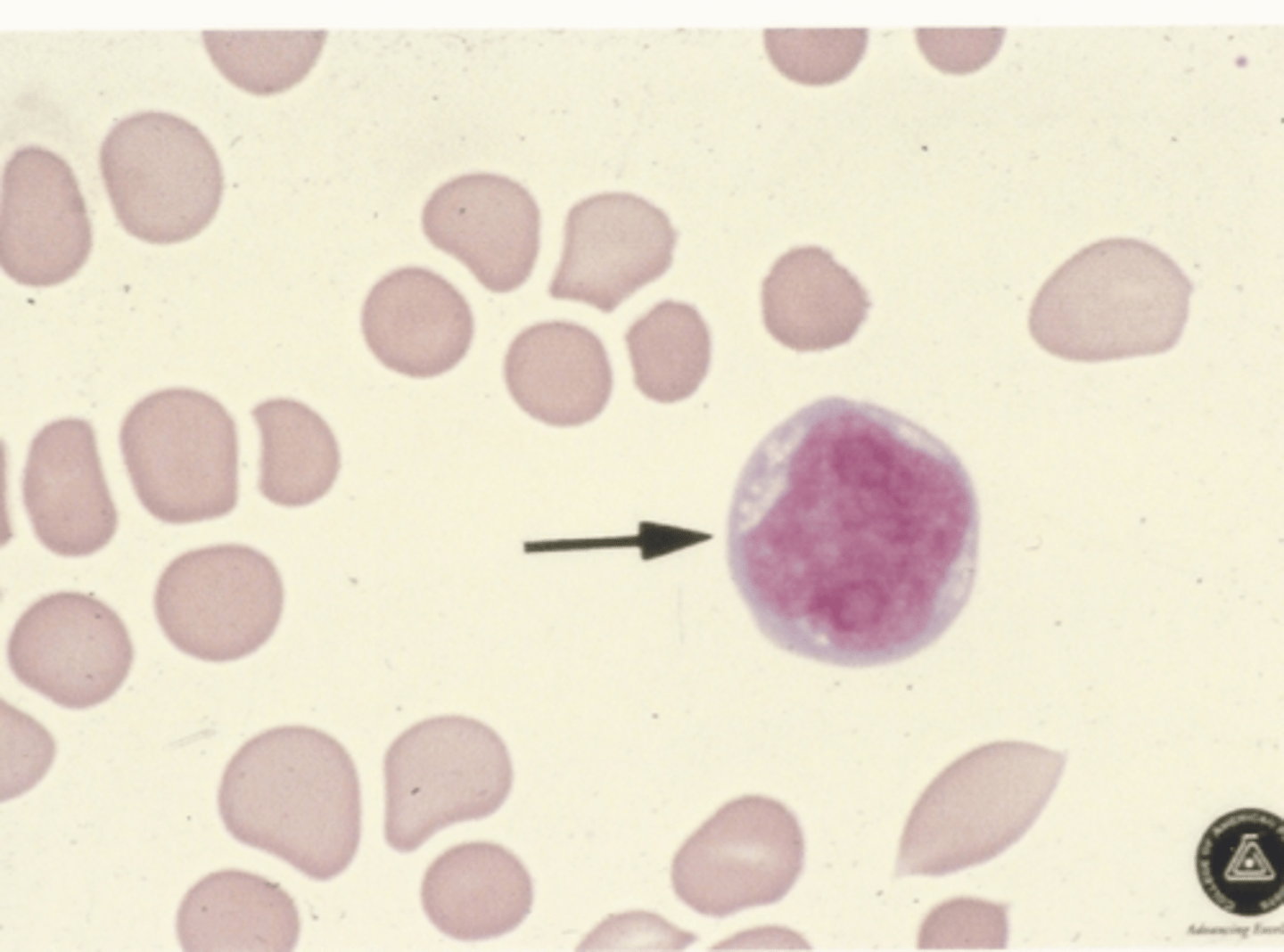 <p>Identify the cells in this body fluid</p>