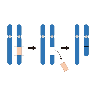 <p>Partial chromosome deletion caused by a chromosome breakage at 2 points </p>