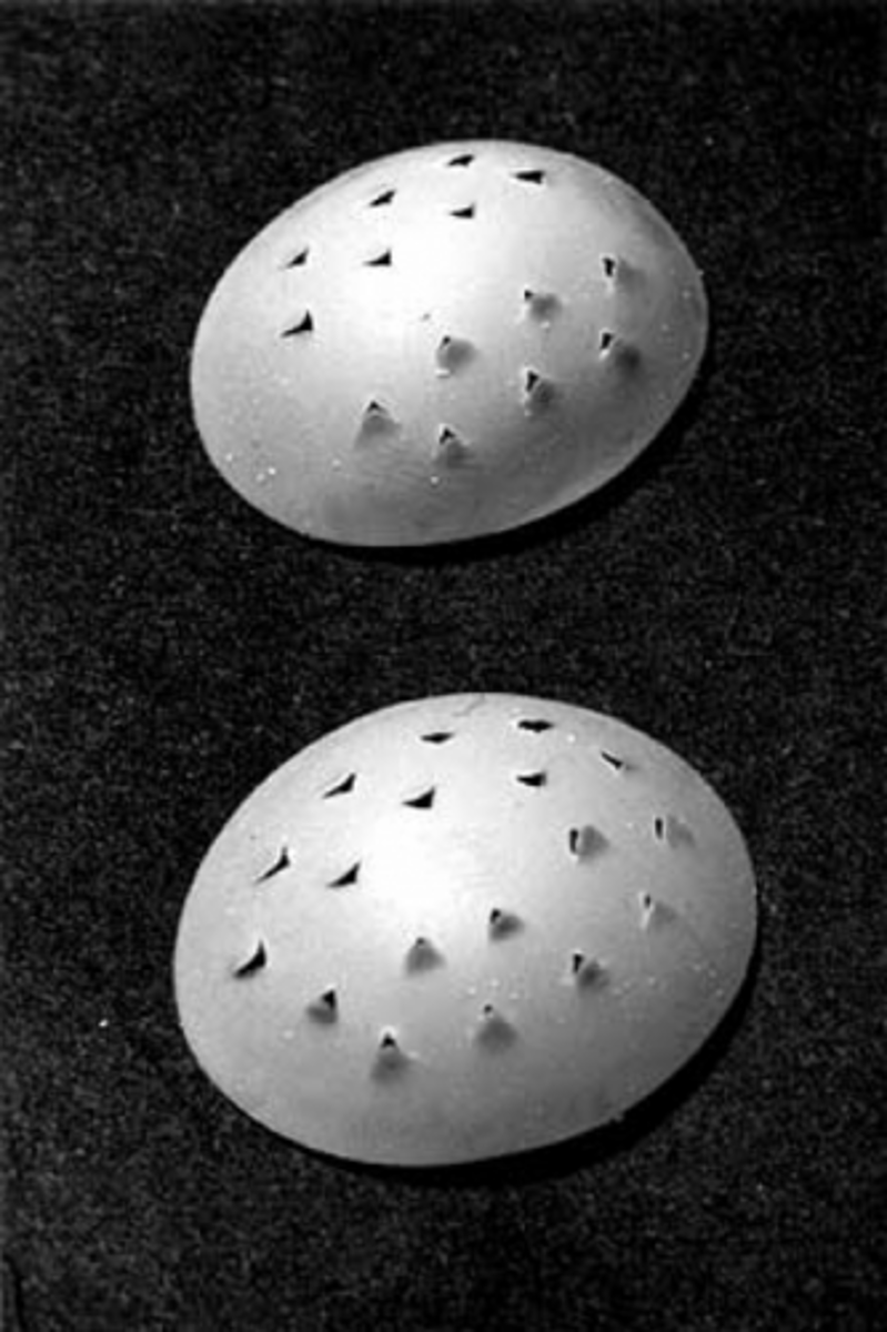 <p>plastic disks inserted beneath the eyelids to maintain closure and contour the closed eye; may be clear or opaque</p>