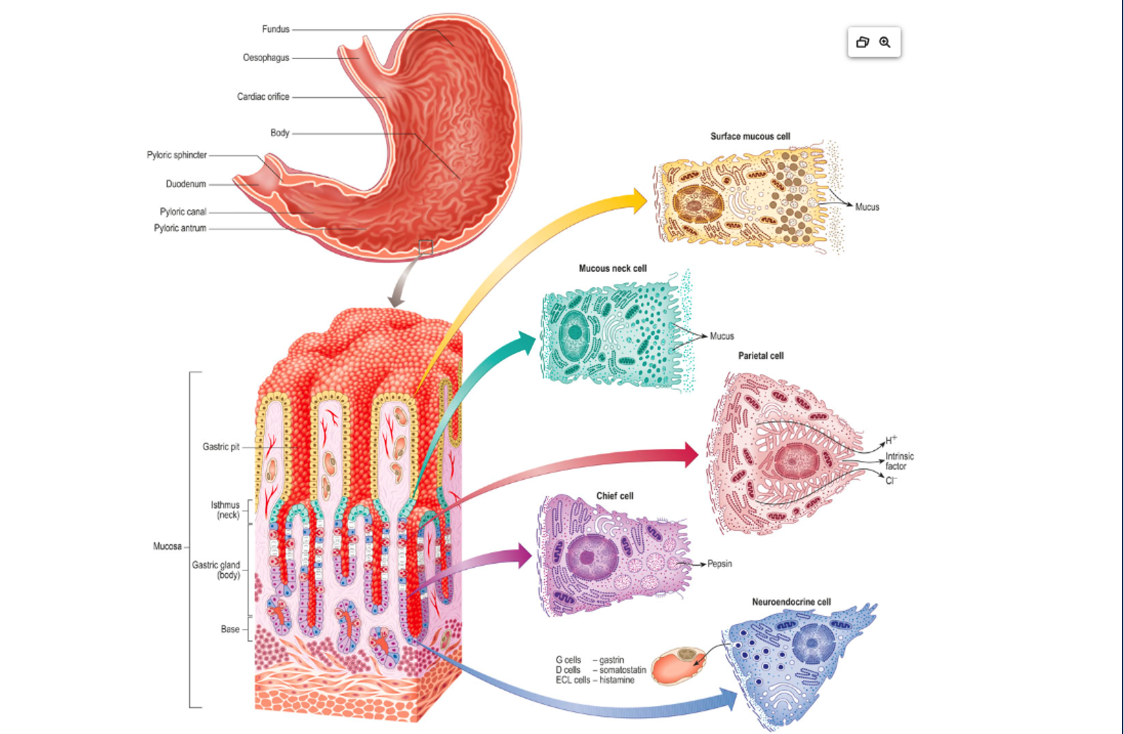 <p><strong>About Stomach Anatomy:</strong></p><ol><li><p><strong>What are the main regions of the stomach shown in the diagram?</strong> The main regions of the stomach shown are the Fundus, Esophagus, Cardiac orifice, Body, Pyloric sphincter, Duodenum, Pyloric canal, and Pyloric antrum.</p></li><li><p><strong>Where does the esophagus connect to the stomach?</strong> The esophagus connects to the stomach at the Cardiac orifice.</p></li><li><p><strong>What part of the stomach connects to the duodenum?</strong> The Pyloric sphincter connects the stomach to the Duodenum.</p></li><li><p><strong>Can you identify the different parts of the pylorus?</strong> Yes, the parts of the pylorus identified are the Pyloric antrum, Pyloric canal, and Pyloric sphincter.</p></li></ol><p><strong>About Gastric Gland Structure:</strong></p><ol start="5"><li><p><strong>What are the main structural components of a gastric gland?</strong> The main structural components of a gastric gland shown are the Gastric pit, Isthmus (neck), Mucosa (which contains the Gastric gland body), and the Base.</p></li><li><p><strong>Where are the gastric pits located in relation to the gastric glands?</strong> Gastric pits are invaginations from the surface of the mucosa, leading down into the gastric glands. They are essentially the openings of the gastric glands onto the stomach lumen.</p></li><li><p><strong>What is the significance of the "isthmus (neck)" and "body" regions of the gastric gland?</strong> The "isthmus (neck)" and "body" regions of the gastric gland represent different zones where specific types of cells are predominantly located, contributing to the specialized secretions of the stomach. For instance, mucous neck cells are found in the neck, while parietal and chief cells are more abundant in the body.</p></li></ol><p><strong>About Specific Cell Types and Their Secretions/Functions:</strong></p><ol start="8"><li><p><strong>What are the different types of cells found in the gastric glands?</strong> The different types of cells found in the gastric glands, as shown, are Surface mucous cells, Mucous neck cells, Parietal cells, Chief cells, and Neuroendocrine cells.</p></li><li><p><strong>Which cell type is responsible for producing mucus on the surface of the stomach?</strong> The Surface mucous cells are responsible for producing mucus on the surface of the stomach.</p></li><li><p><strong>What do mucous neck cells secrete, and where are they located?</strong> Mucous neck cells secrete mucus. They are located in the "isthmus (neck)" region of the gastric glands.</p></li><li><p><strong>Which cells produce hydrochloric acid (HCl) and intrinsic factor? Why is intrinsic factor important?</strong> Parietal cells produce hydrochloric acid (HCl) and intrinsic factor. Intrinsic factor is crucial for the absorption of vitamin B12 in the small intestine. Without it, vitamin B12 deficiency (and pernicious anemia) can occur.</p></li><li><p><strong>What is the primary secretion of chief cells?</strong> The primary secretion of chief cells is Pepsinogen, the inactive precursor to pepsin.</p></li><li><p><strong>What are neuroendocrine cells, and what hormones/substances do they secrete (e.g., G cells, D cells, ECL cells)?</strong> Neuroendocrine cells are specialized cells that secrete hormones and other substances that regulate digestive functions. As indicated in the diagram, they include:</p><ul><li><p><strong>G cells:</strong> Secrete Gastrin.</p></li><li><p><strong>D cells:</strong> Secrete Somatostatin.</p></li><li><p><strong>ECL cells:</strong> Secrete Histamine.</p></li></ul></li><li><p><strong>How does the structure of each cell type relate to its function (e.g., abundance of mitochondria in parietal cells)?</strong></p><ul><li><p><strong>Parietal cells:</strong> Their large size and prominent intracellular canaliculi with abundant mitochondria reflect the high energy demand for actively pumping H+ ions (for HCl production).</p></li><li><p><strong>Chief cells:</strong> Their basophilic cytoplasm (due to extensive rough endoplasmic reticulum) and apical secretory granules are characteristic of protein-secreting cells (pepsinogen).</p></li><li><p><strong>Mucous cells (surface and neck):</strong> Their cytoplasm is rich in mucin granules, which swell and release mucus upon secretion, providing protection.</p></li><li><p><strong>Neuroendocrine cells:</strong> They contain dense-cored granules characteristic of cells that store and release peptide hormones.</p></li></ul></li><li><p><strong>Trace the path of food through the stomach, highlighting the relevant anatomical structures.</strong> Food enters the stomach from the Esophagus, passing through the Cardiac orifice. It then enters the main body of the stomach (Fundus and Body). After digestion, the partially digested food (chyme) passes through the Pyloric antrum, Pyloric canal, and finally exits the stomach through the Pyloric sphincter into the Duodenum.</p></li></ol><p><strong>Comparative/Integrative Questions:</strong></p><ol start="16"><li><p><strong>How do the different cell types in the gastric gland work together to contribute to stomach digestion?</strong> The different cell types work synergistically:</p><ul><li><p><strong>Mucous cells</strong> protect the stomach lining from acid.</p></li><li><p><strong>Parietal cells</strong> produce HCl for protein denaturation and activation of pepsinogen, and intrinsic factor for B12 absorption.</p></li><li><p><strong>Chief cells</strong> produce pepsinogen, which is activated by HCl into pepsin for protein digestion.</p></li><li><p><strong>Neuroendocrine cells</strong> release hormones that regulate the activity of other gastric cells (e.g., gastrin stimulates HCl secretion, somatostatin inhibits it, histamine enhances it). This coordinated effort ensures efficient chemical digestion and protection of the stomach wall.</p></li></ul></li><li><p><strong>Are all these cell types found uniformly throughout the stomach, or do their distributions vary by region?</strong>The distribution of these cell types varies by region. For example:</p><ul><li><p>Surface mucous cells cover the entire luminal surface.</p></li><li><p>Parietal and Chief cells are most abundant in the glands of the fundus and body of the stomach.</p></li><li><p>Neuroendocrine cells (like G cells) are more concentrated in the pyloric antrum. Mucous neck cells are found in the neck region of glands throughout.</p></li></ul></li><li><p><strong>How do the secretions from these cells affect the pH within the stomach lumen?</strong> The primary factor affecting the pH is the large amount of HCl secreted by the Parietal cells, which makes the stomach lumen highly acidic (pH typically 1.5-3.5). The mucus secreted by Surface mucous cells and Mucous neck cells helps to buffer this acidity at the epithelial surface, protecting the stomach lining from self-digestion, but the bulk lumen remains very acidic.</p></li></ol><p></p>