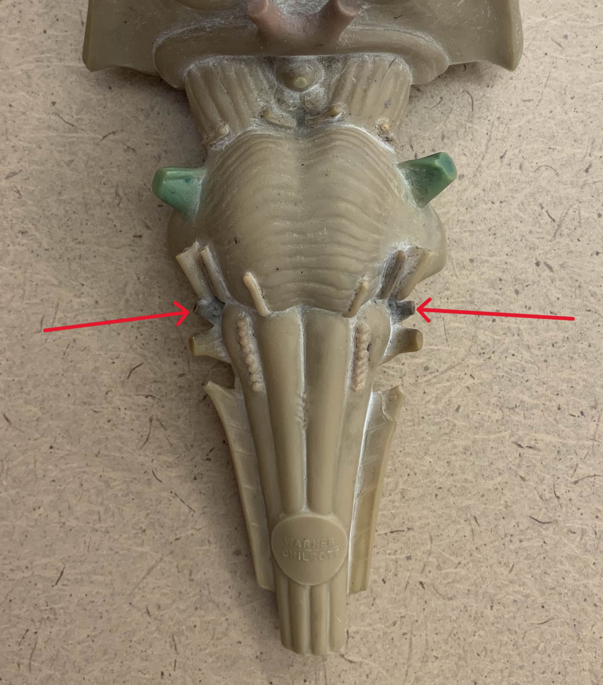 <p>Which nerve of the brain is:</p><ul><li><p>Inferior to vestibulocochlear</p></li><li><p>Superior to vagus</p></li></ul><p></p>