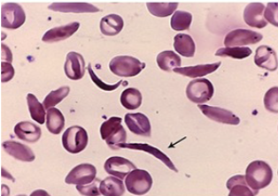 <p>what cells are these?</p>