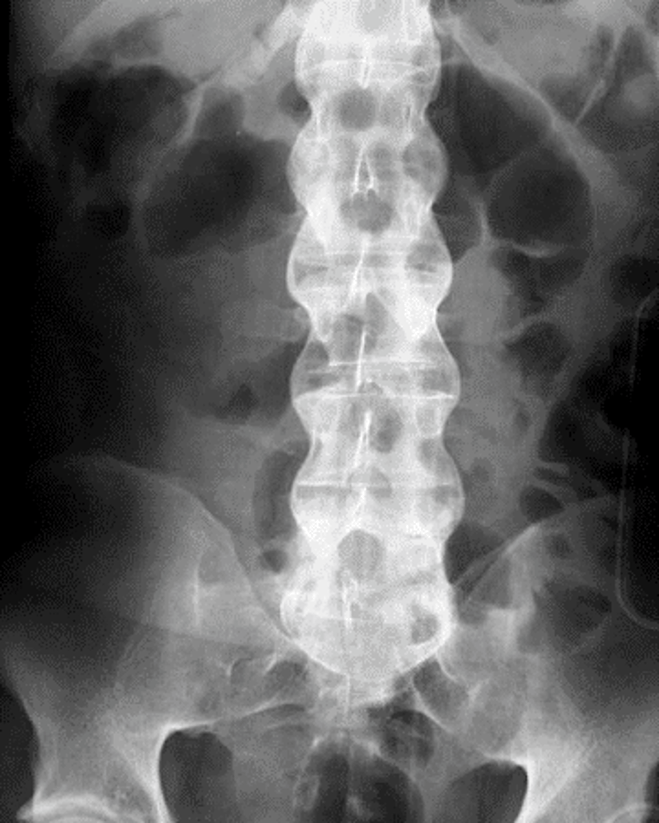<p>X-ray</p>