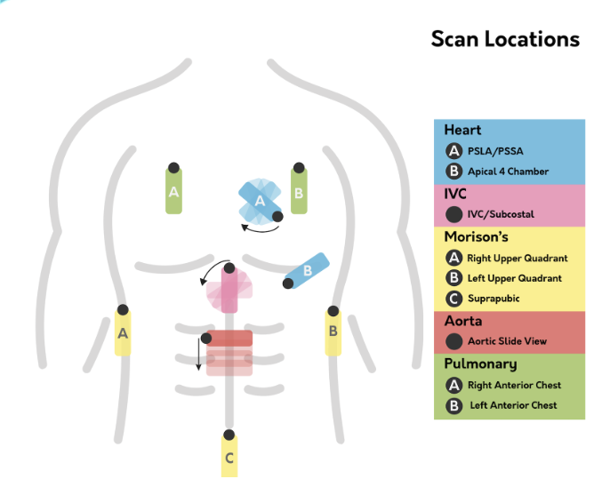 <p>Review the probe positions </p>
