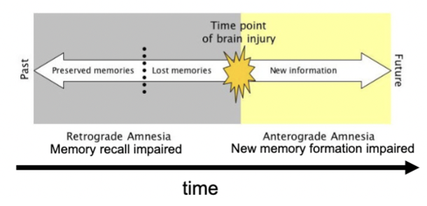 <p>certain brain injuries, drugs impairing encoding, consolidation or retrieval of long-term memories</p><ul><li><p>categorized by info lost relative to time of brain insult</p></li></ul><p></p>