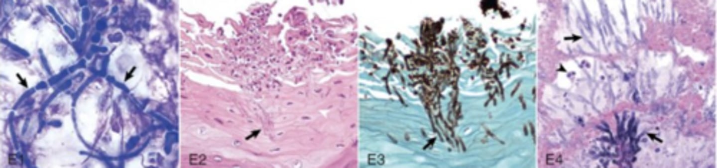 <p>What broad group of pathogens does these images indicate ?</p>