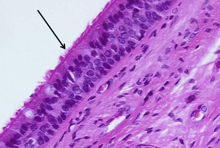 <ul><li><p>The cells are all <strong>tall and columna,&nbsp;</strong></p></li></ul><ul><li><p>Looks like multiple layers, but actually just one</p></li></ul><ul><li><p>Nuclei at different heights → “messy, staggered” look.</p></li></ul><ul><li><p>Has <strong>cilia</strong> on the surface + <strong>mucus-secreting goblet cells</strong>.</p></li></ul><p></p>