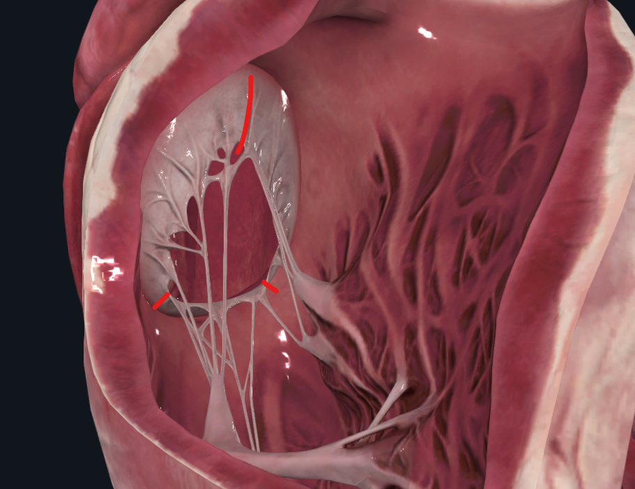<p>Válvula auriculoventricular de lado derecho</p><ul><li><p>Cerrada en sístole</p></li></ul><p></p>