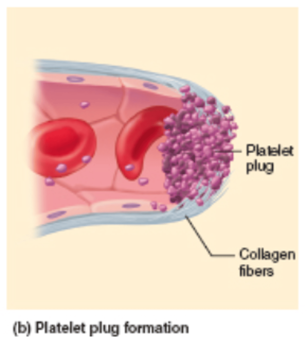 <p>a collection of platelets at the site of a damaged blood vessel that helps slow or stop blood loss</p>